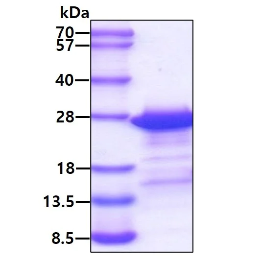 SDS-PAGE - Recombinant Human PCNP protein (His tag N-Terminus) (AB113147)