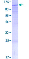 SDS-PAGE - Recombinant Human PCQAP / MED15 protein (AB162600), expandable thumbnail