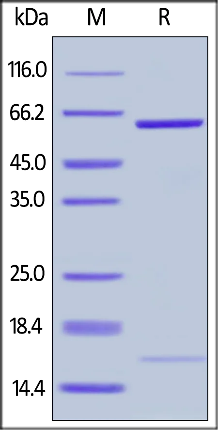 SDS-PAGE - Recombinant human PCSK9 (mutated D374Y) protein (Active) (AB223014)