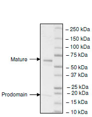 Recombinant human PCSK9 protein