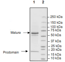 SDS-PAGE - Recombinant human PCSK9 protein (Biotin) (6x His tag C-Terminus + Avi tag C-Terminus) (AB198753)