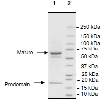SDS-PAGE - Recombinant human PCSK9 protein (Biotin) (AB198753)