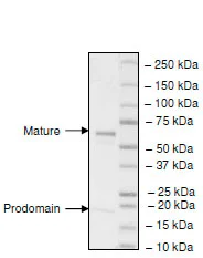 SDS-PAGE - Recombinant human PCSK9 protein (His tag C-Terminus) (AB198471)