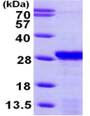 SDS-PAGE - Recombinant Human PDAP1 protein (His tag C-Terminus) (AB99246)