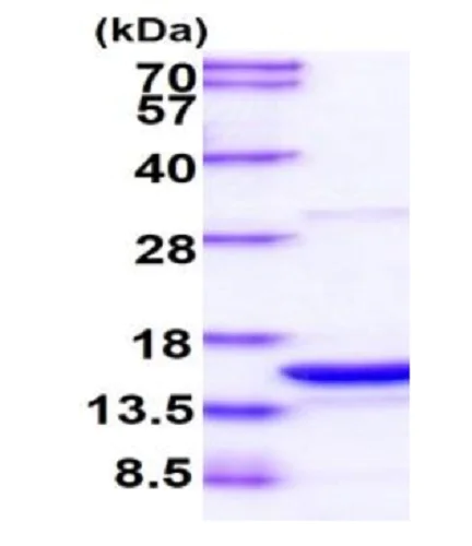 SDS-PAGE - Recombinant Human PDCD5 protein (Tag Free) (AB235622)