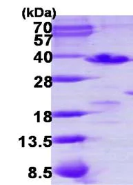 SDS-PAGE - Recombinant Human PDCL3 protein (His tag N-Terminus) (AB123207)