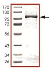 SDS-PAGE - Recombinant Human PDE12 protein (AB107695)