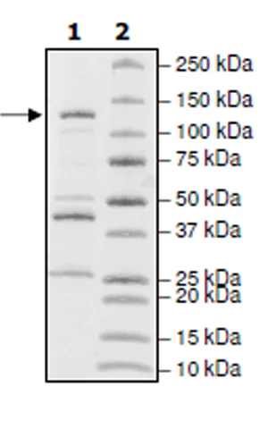 SDS-PAGE - Recombinant human PDE2A protein (Active) (AB271676)