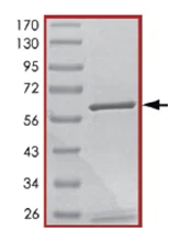 SDS-PAGE - Recombinant human PDE5A/PDE5 protein (AB125581)