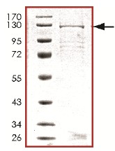 Recombinant Human PDE6C protein