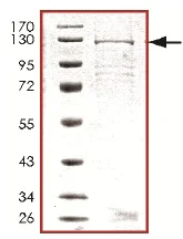 SDS-PAGE - Recombinant Human PDE6C protein (AB125587)
