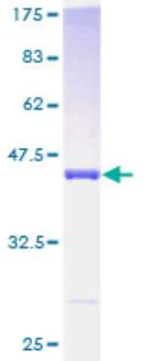 SDS-PAGE - Recombinant Human PDE6D protein (Tagged) (AB275909)