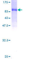 SDS-PAGE - Recombinant Human PDE9A protein (AB159078)