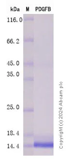 SDS-PAGE - Recombinant Human PDGF B Protein Standard (AB316556)