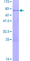 SDS-PAGE - Recombinant Human PDGFC protein (AB132727), expandable thumbnail