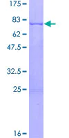 SDS-PAGE - Recombinant Human PDGFC protein (GST tag N-Terminus) (AB132727)