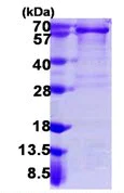 SDS-PAGE - Recombinant Human PDGFR alpha protein (AB109932)