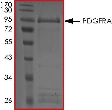 SDS-PAGE - Recombinant human PDGFR alpha protein (AB84797)