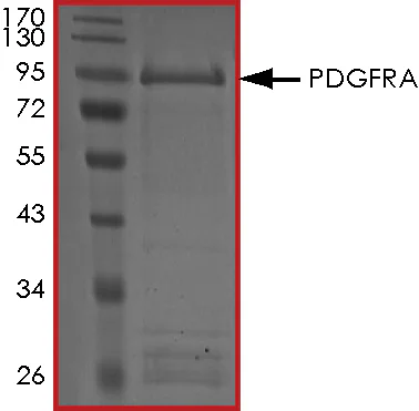 SDS-PAGE - Recombinant human PDGFR alpha protein (GST tag N-Terminus) (AB84797)