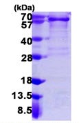 SDS-PAGE - Recombinant Human PDGFR alpha protein (His tag N-Terminus) (AB109932)