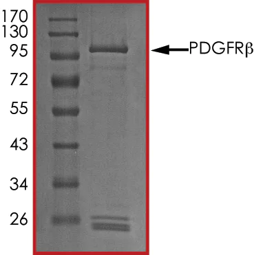 SDS-PAGE - Recombinant human PDGFR beta protein (AB60833)