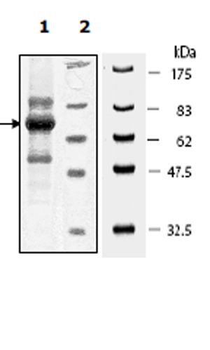 Recombinant human PDGFR beta protein (Active)