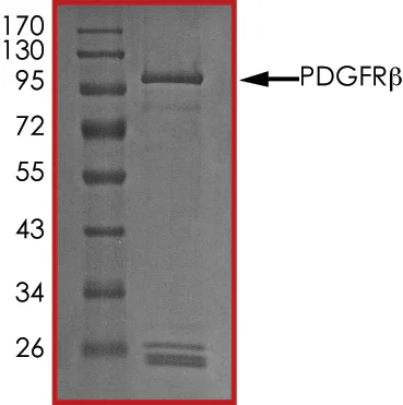 SDS-PAGE - Recombinant human PDGFR beta protein (GST tag N-Terminus) (AB60833)