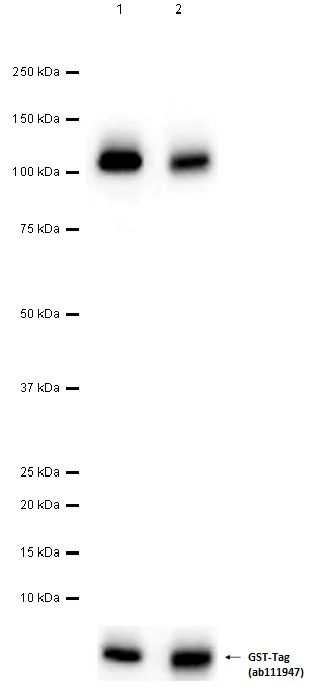 Western blot - Recombinant human PDGFR beta protein (GST tag N-Terminus) (AB60833)