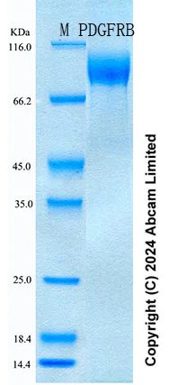 SDS-PAGE - Recombinant Human PDGFRB Protein Standard (His tag) (AB322283)