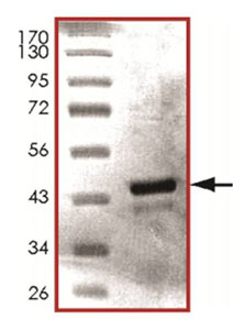 SDS-PAGE - Recombinant Human PDHA1 protein (His tag N-Terminus) (AB125602)