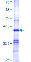 SDS-PAGE - Recombinant Human PDHB protein (AB152601)
