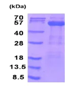 SDS-PAGE - Recombinant Human PDHX protein (His tag N-Terminus) (AB202213)