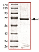Recombinant human PDK2 protein