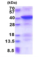 SDS-PAGE - Recombinant Human PDLIM1/CLP36 protein (AB177676)