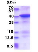 SDS-PAGE - Recombinant Human PDLIM1/CLP36 protein (His tag N-Terminus) (AB177676)