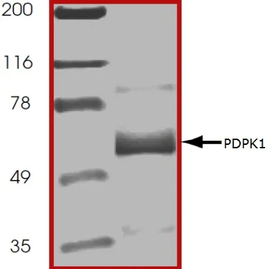 SDS-PAGE - Recombinant human PDPK1 protein (AB60834)