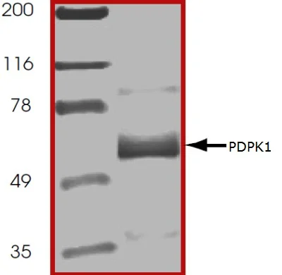 SDS-PAGE - Recombinant human PDPK1 protein (His tag N-Terminus) (AB60834)