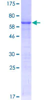 SDS-PAGE - Recombinant Human PDX1 protein (AB114175)