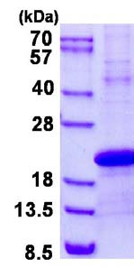 SDS-PAGE - Recombinant Human PDZD11 protein (His tag N-Terminus) (AB134619)