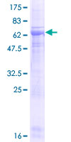 SDS-PAGE - Recombinant Human Pellino-3 protein (AB132822)