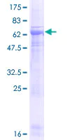SDS-PAGE - Recombinant Human Pellino-3 protein (GST tag N-Terminus) (AB132822)