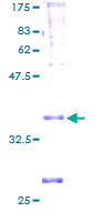Recombinant Human PEN2 protein