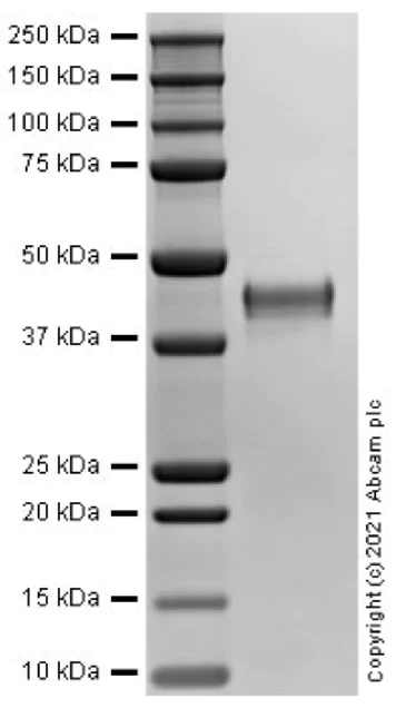 SDS-PAGE - Recombinant Human Pentraxin 3/PTX3 protein (AB283455)