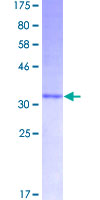 SDS-PAGE - Recombinant Human Peptide YY/PYY protein (AB114446)