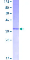 SDS-PAGE - Recombinant Human Peptide YY/PYY protein (GST tag N-Terminus) (AB114446)