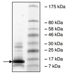 SDS-PAGE - Recombinant Human Peregrin/BRPF1 protein (His tag N-Terminus) (AB196416)