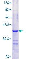 SDS-PAGE - Recombinant Human Perilipin-1 protein (GST tag N-Terminus) (AB112340)