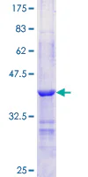 SDS-PAGE - Recombinant Human Perilipin-1 protein (GST tag N-Terminus) (AB112340)