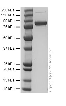 SDS-PAGE - Recombinant Human Periostin protein (His Tag) (AB310788), expandable thumbnail