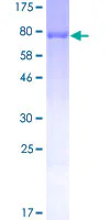 SDS-PAGE - Recombinant Human Peripherin protein (GST tag N-Terminus) (AB114335)